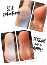 Load image into Gallery viewer, Sole solution cracked feet Lotion