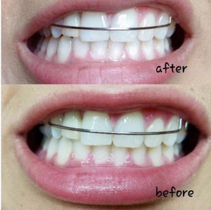 Whitening Toothpaste